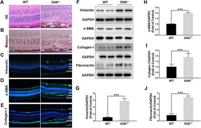 Fenofibrate Inhibits Subretinal Fibrosis Through Suppressing TGF‐β—Smad2/3 signaling and Wnt signaling in Neovascular Age‐Related Macular Degeneration